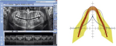 SmartPan imaging system output
