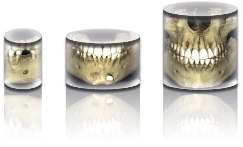 Three separate 3D image views from a cone beam scan